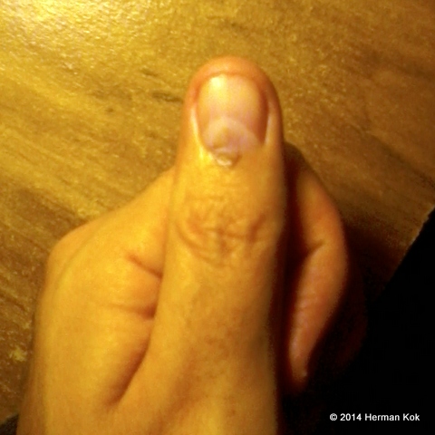 Marked thumb after voting